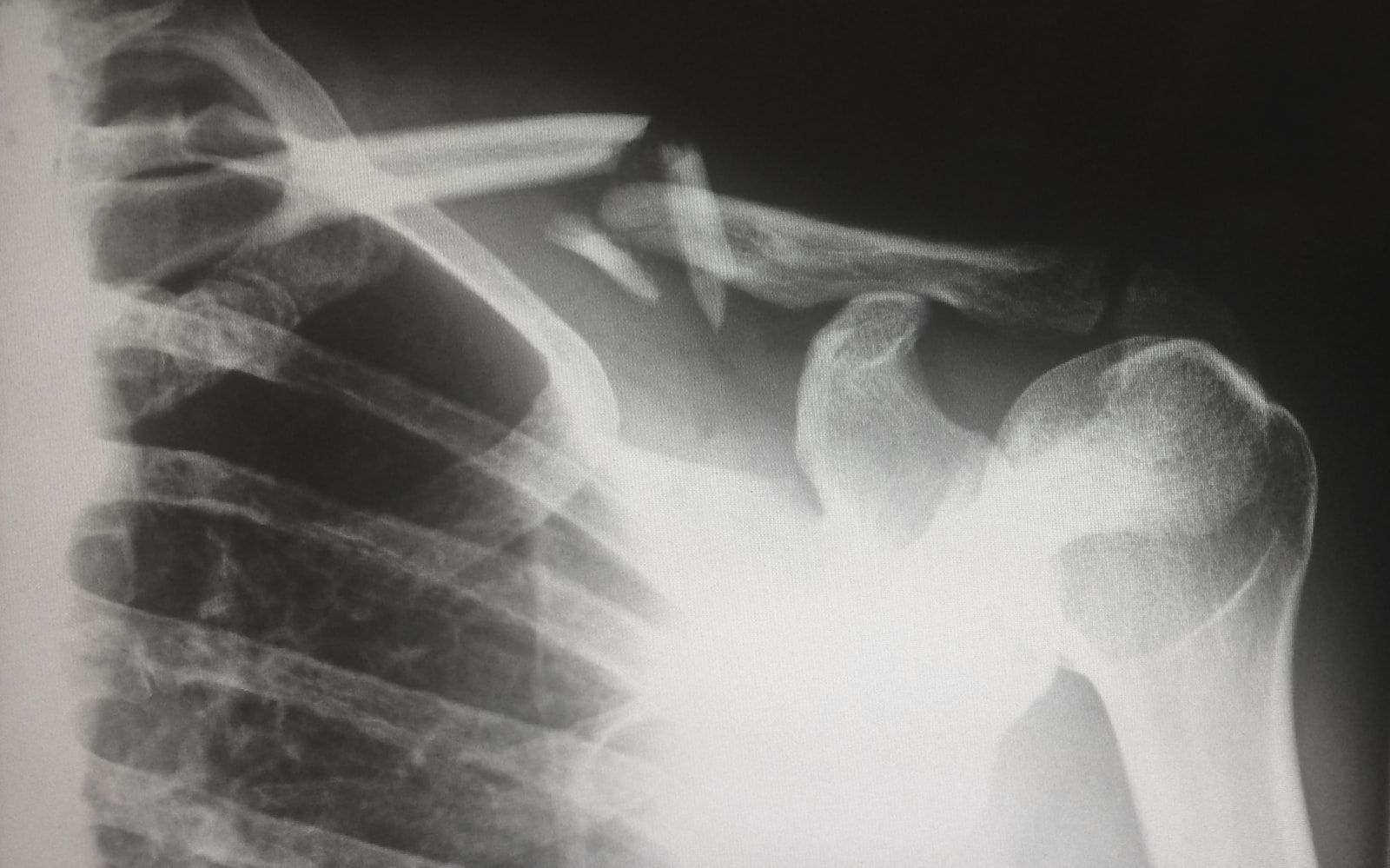Radiografía que muestra la estructura ósea